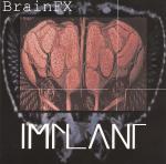 Implant - BrainFX